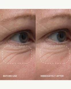 PlantGenius Line-Filling Eye Balm With Bakuchiol 13 PlantGenius Line-Filling Eye Balm With Bakuchiol -WELA Beauty Shop AlpynBeauty PlantGeniusLine FillingEyeBalm BeforeAfter 03