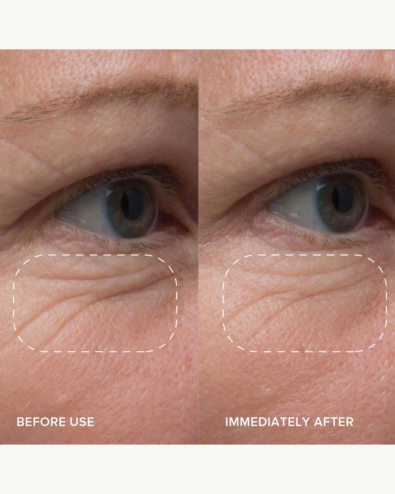 PlantGenius Line-Filling Eye Balm With Bakuchiol 6 PlantGenius Line-Filling Eye Balm With Bakuchiol - Image 4