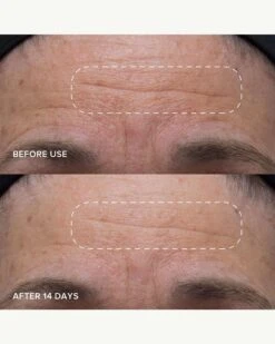 PlantGenius Melt Moisturizer -WELA Beauty Shop AlpynBeauty PlantGeniusMeltMoisturizer BeforeAfter 03