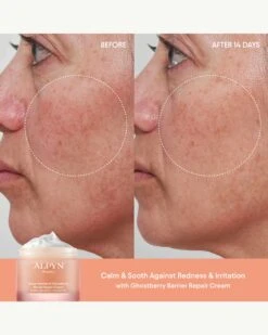 Super Peptide & Ghostberry Barrier Repair Cream -WELA Beauty Shop Alpyn SuperPeptideGhostberryBarrierRepairCream BeforeAfter 03
