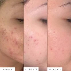 Lapis Facial Oil -WELA Beauty Shop HB003 6