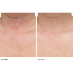 Plumbody™ Body Créme -WELA Beauty Shop LePrunier BA 4wk 032 front neck