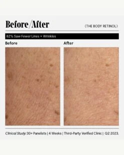 The Body Retinol -WELA Beauty Shop Necessaire TheBodyRetinol BeforeAfter 11
