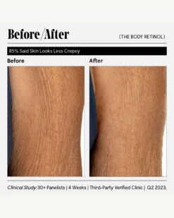 The Body Retinol -WELA Beauty Shop Necessaire TheBodyRetinol BeforeAfter 12