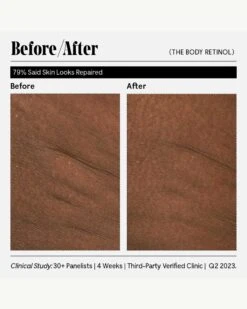 The Body Retinol -WELA Beauty Shop Necessaire TheBodyRetinol BeforeAfter 13
