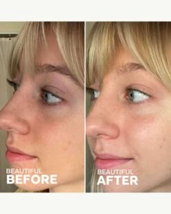 Brighter Days Red Algae + Avocado Biodegradable Eye Masks -WELA Beauty Shop ThreeShips BrighterDaysEyeMask BeforeAfter 05