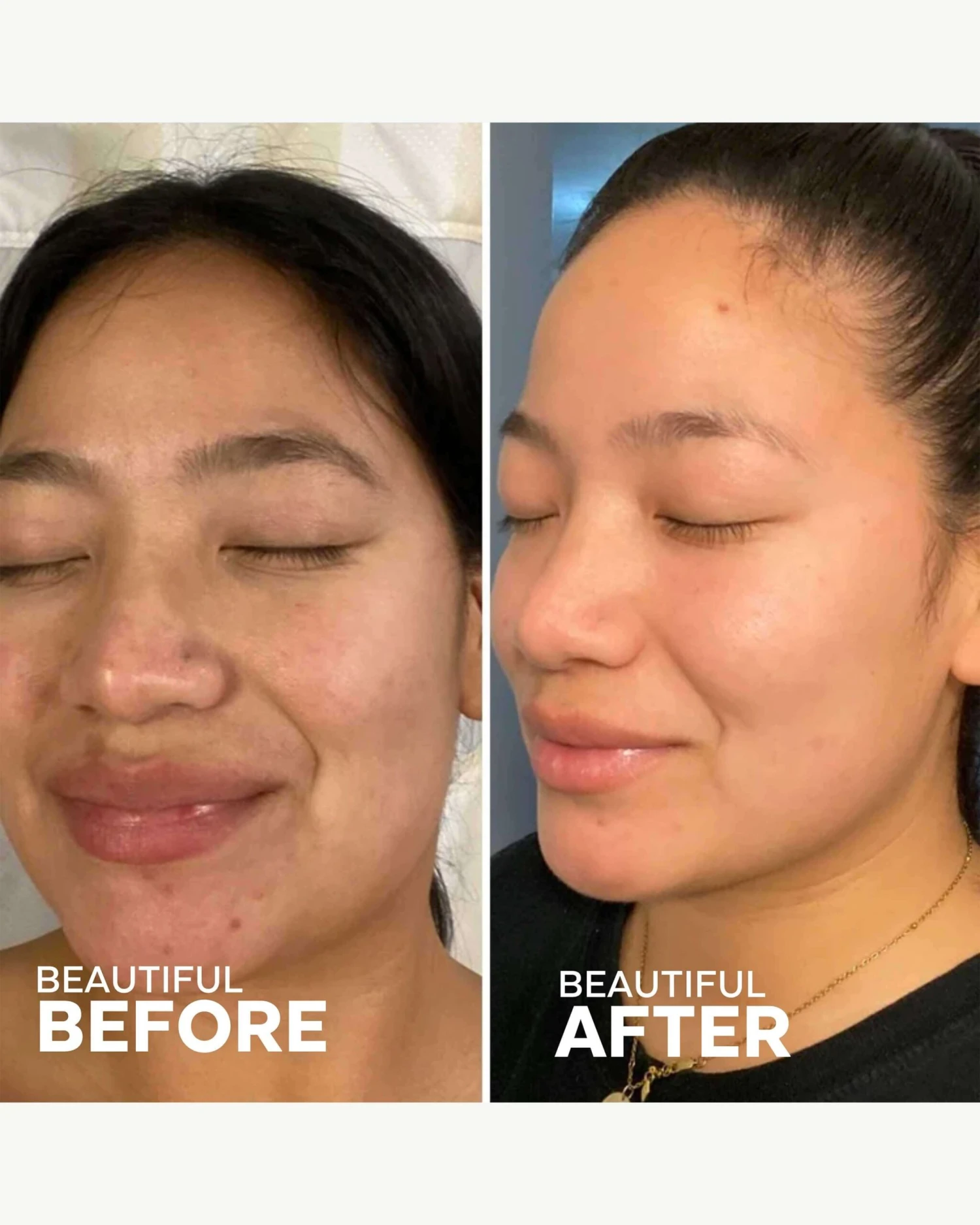 Dream Bio-Retinol + Shorea Butter Night Cream 7 Dream Bio-Retinol + Shorea Butter Night Cream - Image 5